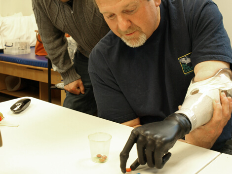 amputee learning to use his prosthetic hand